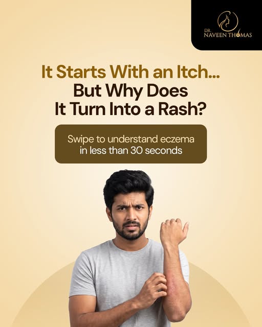 It starts with an itch... but why does it turn into a rash? 🤔

Eczema is more than just dry skin. I