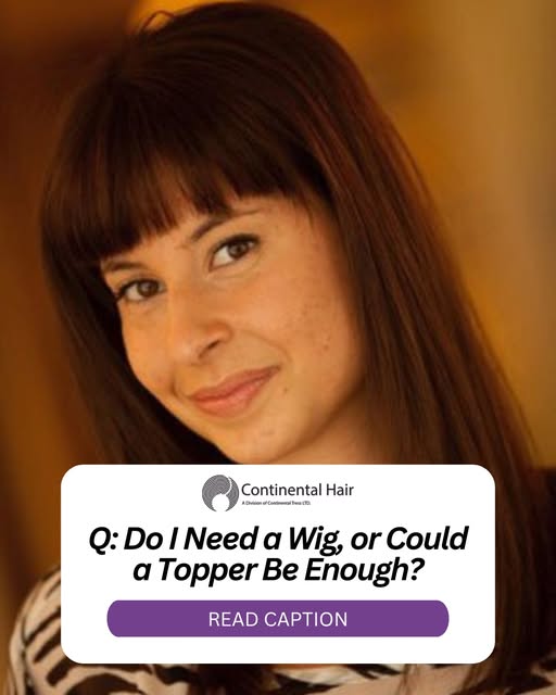 It's one of the most important questions to ask when you're beginning to explore hair replacement.

