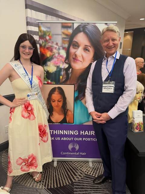 September is Alopecia Areata Awareness Month 💙

A very special thank you to Michael from @continent