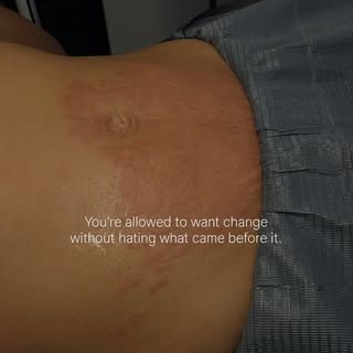 For a long time, we’ve been taught that wanting to change or improve something about our appearance 