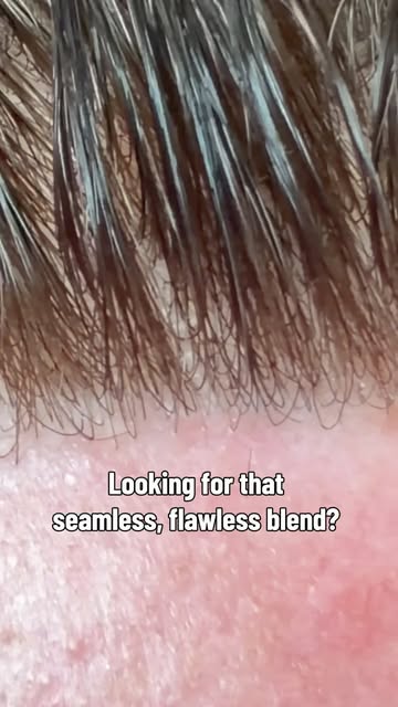 ✨ A great hair system starts with a great hairline.

The hairline is one of the most important steps