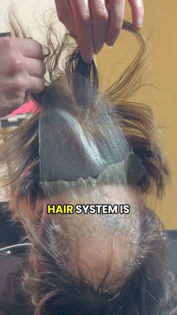 Scalp care starts with the removal 👏🏼

I’ve had a few messages recently from people experiencing s