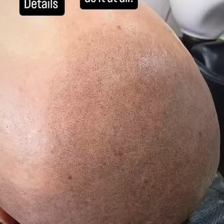 Scalp micro pigmentation details 
#SMPAustralia
#SMPMelbourne
#SMPSydney
#SMPBrisbane
#SMPPerth
#SMP