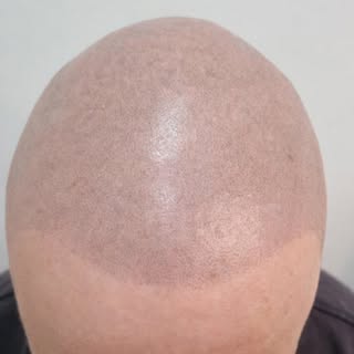“2 YEARS HEALED 🔥
STILL UNDETECTABLE. STILL REAL.”
This is what TRUE SMP looks like after time does