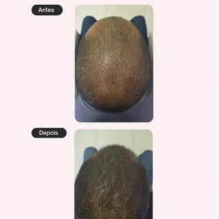 Resultados que falam por si! 👏🏼✨

Cada fio recuperado representa um tratamento personalizado, base
