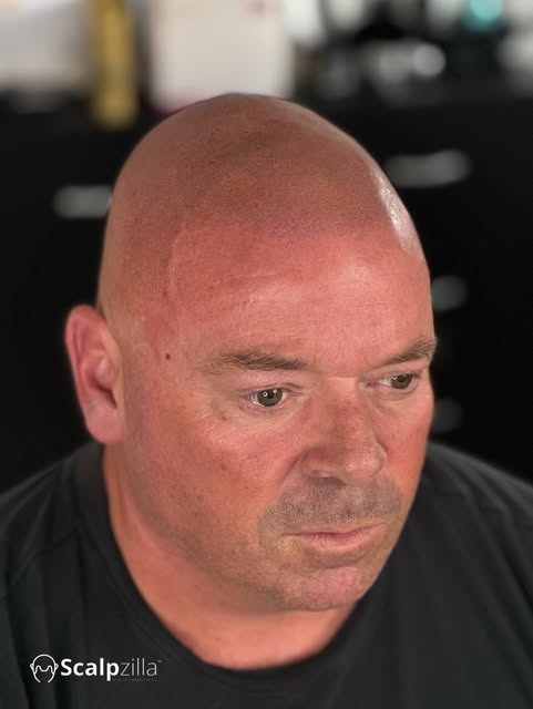 SHAVEN EFFECT SMP ✅

Fresh shaven look ✅ 2nd session for this gentleman, we achieved a perfect resul