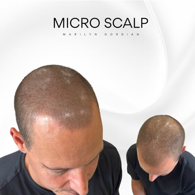 Retouche annuelle 🤗

Ce client vient me voir chaque année pour sa retouche annuelle.

Une retouche 