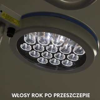 Jak wyglądają włosy po przeszczepie? 🤔
W metodach FUE i DHI nie powstają duże blizny - widoczne są 