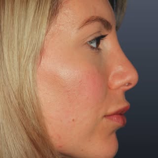 Every result starts with a conversation. This patient's outcome reflects close collaboration with Dr
