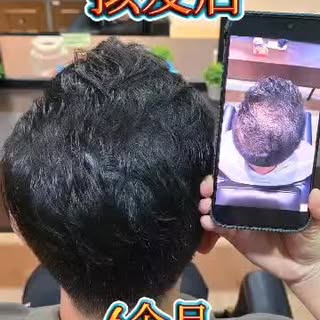 6 months hair growth results 🎉🎉🎉🎉