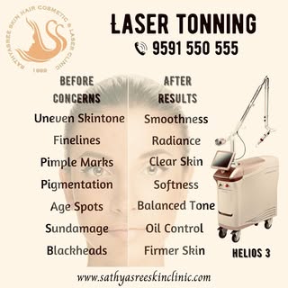 📞 9591 550 555

Laser tonning is a dermatological procedure helpful in improving your skin’s appear