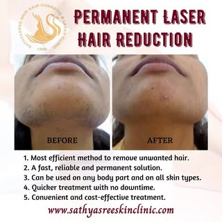 📞 9591 550 555

What is Laser Hair Reduction & How does it work?

1. This procedure works on the pr