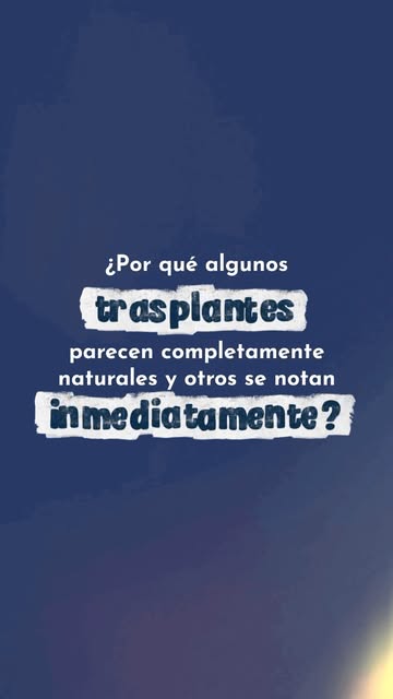 La naturalidad de un trasplante capilar no depende solo de la cantidad de cabello. 💆🏼‍♀️

La direc