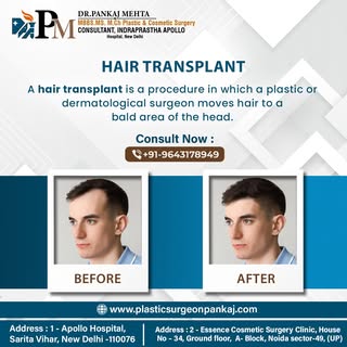Transform your look with a hair transplant procedure. Check out these before and after photos and se