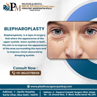 Transform your look with blepharoplasty! This surgical procedure is designed to rejuvenate the eyes 