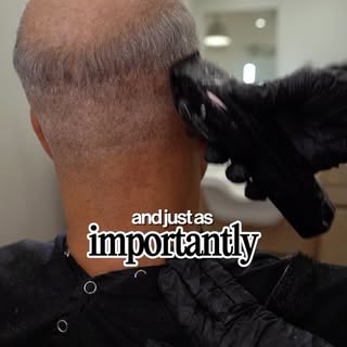 Does it matter how bald you are when getting a hair system? Yes, but probably not in the way you thi