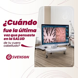 ¿Cuándo fue la última vez que pensaste en la SALUD de tu cuero cabelludo? 🛑 Un cabello que se cae, 