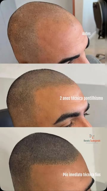 Ele mudou a técnica. Qual você prefere?