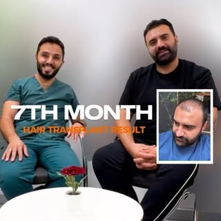 We don’t just perform hair transplants, we also create art. 🖼️ 
Hairline 

✅ Hair Transplant
✅ Bear