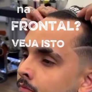 Contato na bio do instagram. Fale conosco!!#protesecapilar #