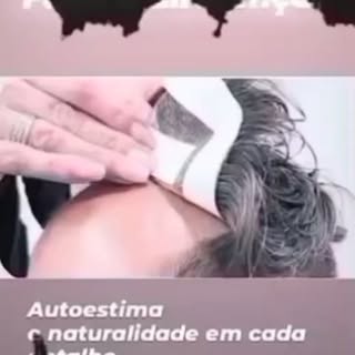 Procurando solução para a calvície? Achou.  Seu cabelo de volta em instantes. Contato na bio #protes