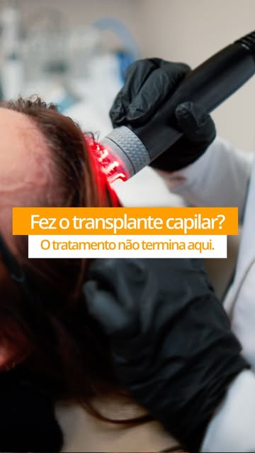 Já fez transplante capilar e quer maximizar o resultado? Mesmo que tenha sido em outro local.

Com p