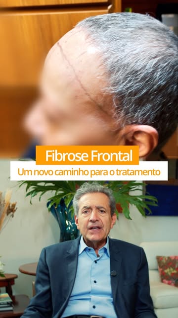 Couro cabeludo atrofiado pela Fibrose Frontal? Existe um passo antes do transplante.

O Nano Fat pre