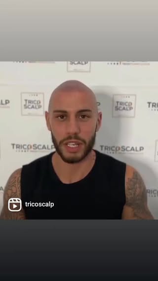 Grazie a vuoi che vi affidate totalmente a me … ONORATO #tricoscalp