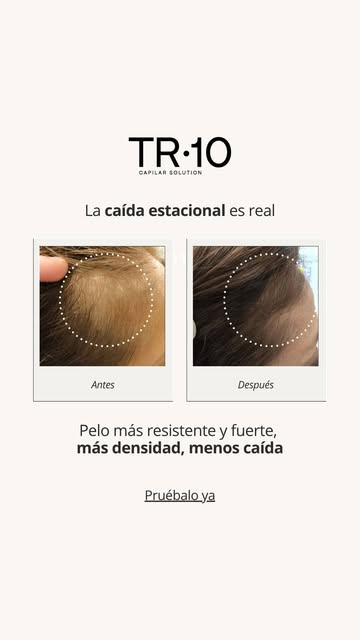 EL CAMBIO DE ESTACIÓN ES UNA SEÑAL PARA VOLVER A PONER EL FOCO EN TU CABELLO 🍂

La caída estacional
