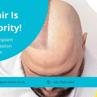 Transform your look with confidence! 🌟 At Harley Street, Your Hair Is Our Priority! 💇‍♂️ Book your