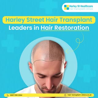 🔍 Discover excellence in hair restoration. With expertise and exclusive locations in the UK, we lea