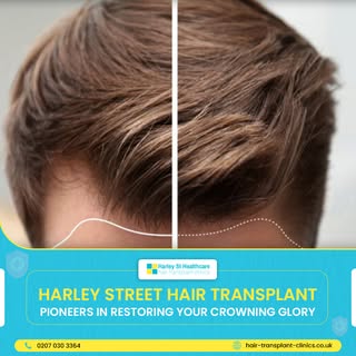 Take charge against hair loss by delving into the roots of knowledge. Tune in for expert insights fr