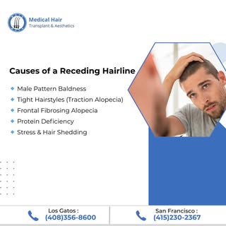 What's Causing Your Receding Hairline?
From male pattern baldness to stress & nutritional deficienci