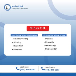 FUE vs FUT: Which Hair Transplant is Right for You?
Choosing between FUE and FUT? Both are highly ef
