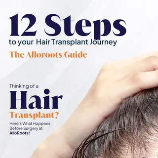 Your Complete Hair Transplant Journey—The AlloRoots Guide

🎯 What actually happens before, during, 