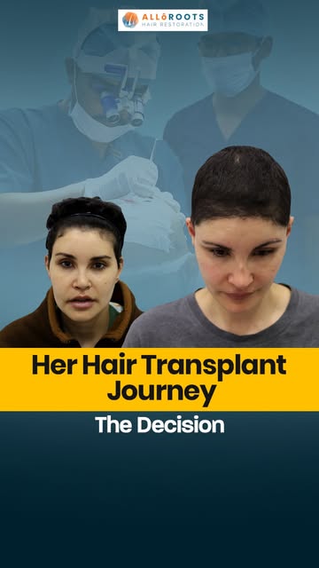 She flew from London to Delhi for a hair transplant… but surgery was only the beginning.

What happe