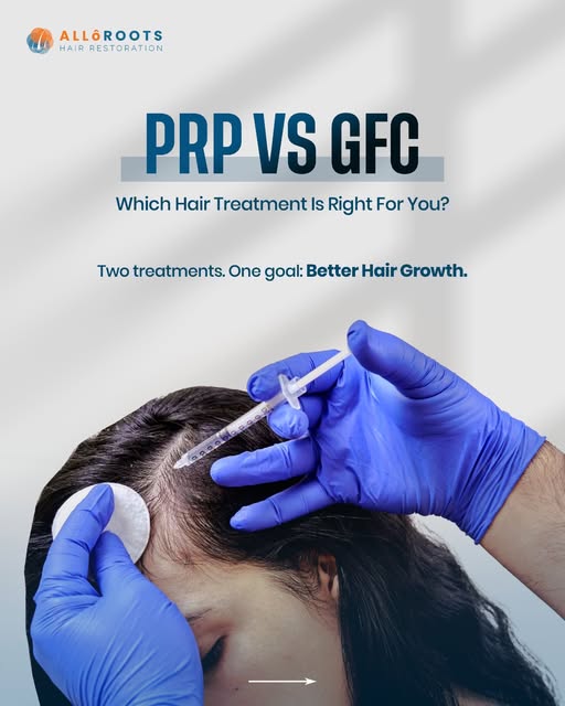 PRP vs GFC for Hair Loss — Which is right for you? 👀

Both can support hair growth, but the right t