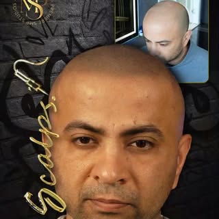 ❤️
.
.
.
.
.

📆 Book a Free Consultation
👑 World Class SMP 
🌎 Scalpsusa.com 
🎯 When Every Impres