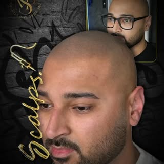 Subtle work. Serious change. ⚔️🖤🎯
.

📆 Book a Free Consultation
👑 World Class SMP 
🌎 Scalpsusa.