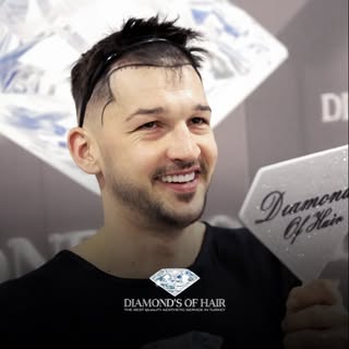 💎 Diamond’s of Hair 
Hair Transplant Center

With a team of 12+ years of experience and more than 1