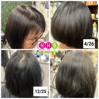 Yes, your hair can transform back into healthy, thriving hair. Through holistic wellness, scalp care