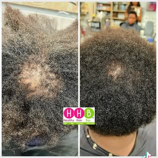 men’s hair loss is becoming a growing concern, and more men are looking for real solutions. You don’