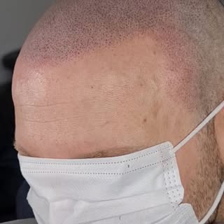 ®️

If you love my work, then you ♥️ me.!

This is not hair follicles.!!! This is a TATTOO..!!

#hai