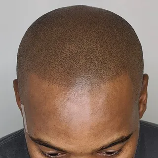 ®️

That's right its a tattoo.!!

Interested? Hit my DM'S

#scalpmicropigmentation
#hairfibers
#hair