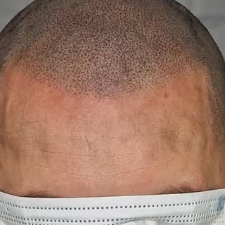 ®️

No this is a hair tattoo done the right way..!

This is not hair...!!! This is a TATTOO...!

Int