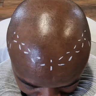 ®️

I replicate stubble...!! That's it simple as..!!

Interested? Dm me for a FREE consultation 

#h
