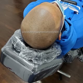Tattoed Scalp.... 🧐 so natural looking, you can't tell where the real hair starts 😉