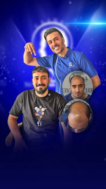 تراکم رو همه توی عکس نشون میدن…

ولی سوال اصلی اینه:
موهات بعد از کاشت، حالت هم می‌گیرن؟ 👀

این وید