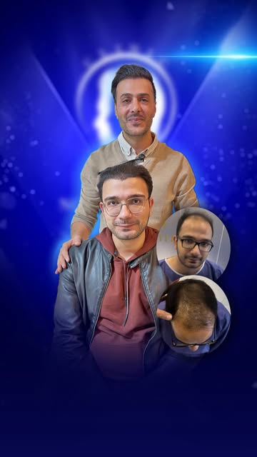 این نتیجه رو بدون فیلتر، شفاف و واضح ببین!

ایندفعه شما بهای کاشت موی آقا محمد رو برای ما کا**منت کن