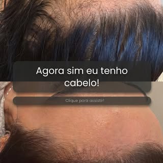 “Agora sim eu tenho cabelo.” 🥹✨

Tem frases que parecem simples, mas carregam uma história inteira 
